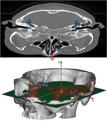 A New Coordinate System for Magnetic Resonance Imaging of the Vestibular System